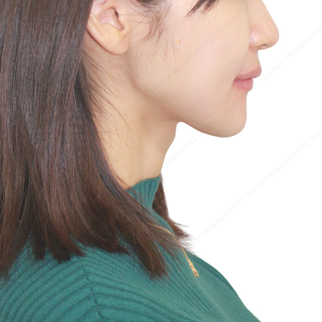 顎や顔立ちを美しく整えたい患者さんへ