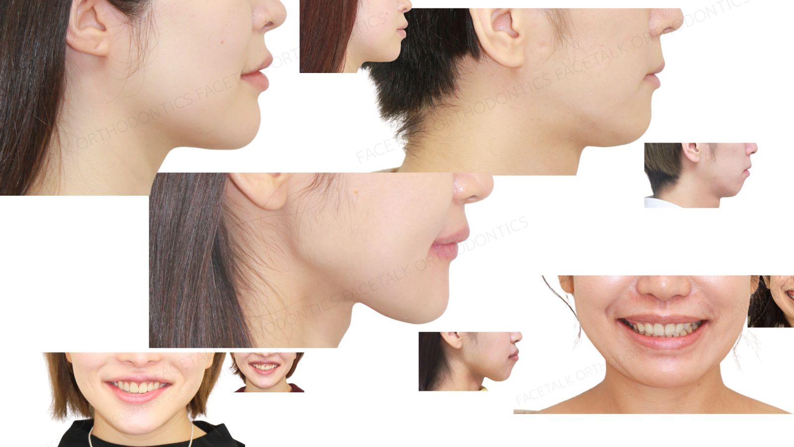 医療法人社団 FACE AND SMILE フェイストーク麻布十番矯正歯科 | 矯正
